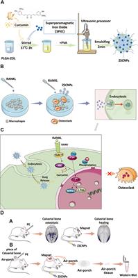 Targeted Delivery of Curcumin to Polyethylene-Induced Osteolysis by Magnetically Guided Zoledronate-Anchored Poly Lactic-Co-Glycolic Acid Nanoparticles via Repressing NF-κB Signaling